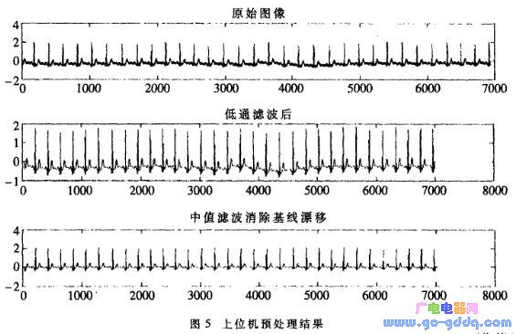 从预处理后的波形可以看出,在采集过程中产生的基线漂移和50hz工频