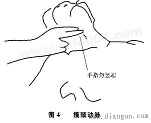 颈动脉触摸正确手法图片