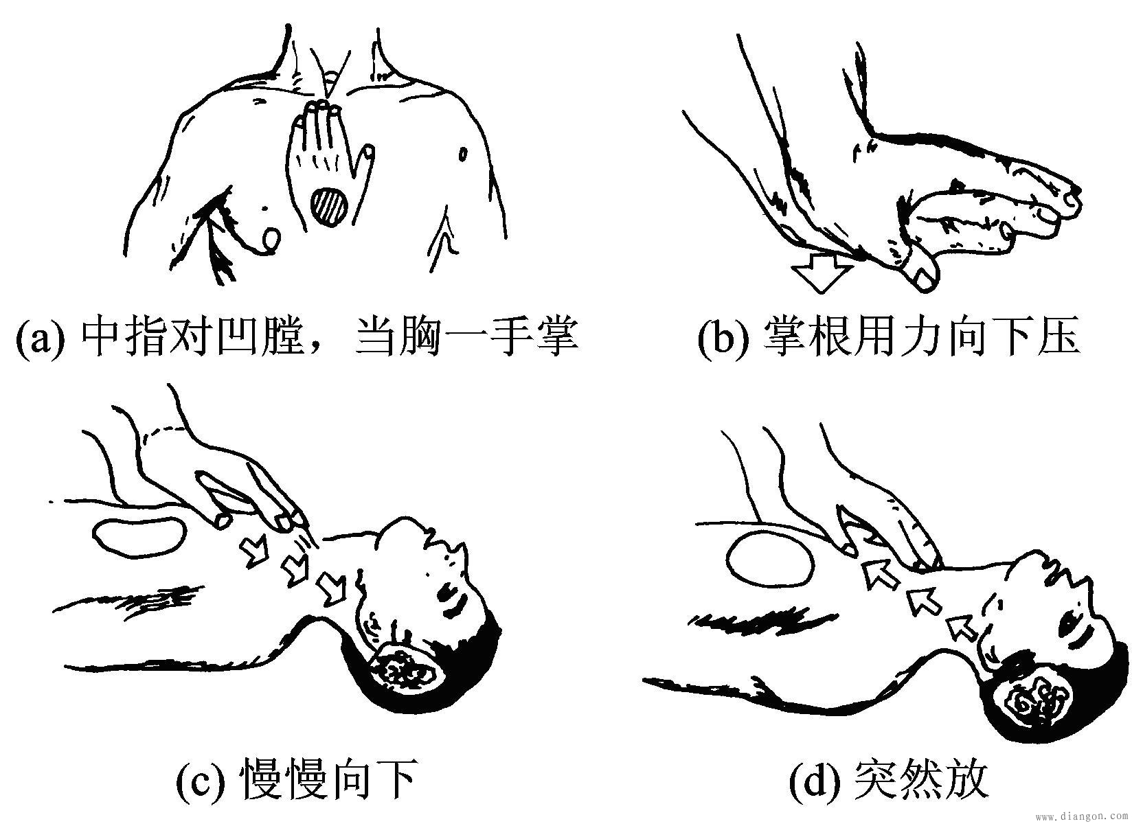 ⑤ 重複進行,直至觸電者的心跳,呼吸恢復.